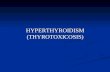 HYPERTHYROIDISM (THYROTOXICOSIS). THYROTOXICOSIS & HYPERTHYROIDIDM Thyrotoxicosis = the clinical sdr that results when tissues are exposed to high levels.