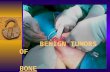 BENIGN TUMORS OF BONE Dr. Abdulla Bin-shehna. BENIGN TUMARS OF BONE 1-cystic lesions 2-fibrous lesions 3-cartilaginous lesions 4-benign (occasionally.