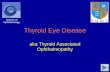 Thyroid Eye Disease aka Thyroid Associated Ophthalmopathy Institute of Ophthalmology.