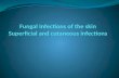 Skin fungal infections Clinical Skin fungal infections are generally divided into Superficial Tinea versicolor, Piedra (Trichosporosis), and Tinea nigra.