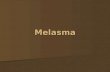 Melasma. Biology of melanocyte Dendritic cell at basal layer of epidermis Dendritic cell at basal layer of epidermis Produce melanin and send to surrounding.