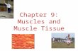 Chapter 9: Muscles and Muscle Tissue. 2 Governor Arnold Schwarzenegger.