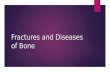 Fractures and Diseases of Bone. Fractures.