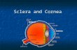 Sclera and Cornea cornea Sclera. Sclera It forms the posterior portion of the globe It forms the posterior portion of the globe It is perforated posteriorly.