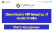 Quantitative MR Imaging of Acute Stroke Risto Kauppinen.