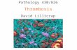 Pathology 430/826 Thrombosis David Lillicrap. Cardiovascular Disease 30% of all deaths in Canada 54% ischemic heart disease 20% stroke 23% heart attack.