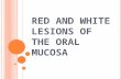 RED AND WHITE LESIONS OF THE ORAL MUCOSA. HEREDITARY WHITE LESIONS REACTIVE/INFLAMMATORY WHITE LESIONS INFECTIOUS WHITE LESIONS AND WHITE AND RED LESIONS.