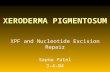 XERODERMA PIGMENTOSUM XPF and Nucleotide Excision Repair Sapna Patel 3-4-04.