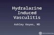 Hydralazine Induced Vasculitis Ashley Keyes, MD.