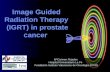 Image Guided Radiation Therapy (IGRT) in prostate cancer MªCarmen Pujades Hospital Universitario La Fe Fundación Instituto Valenciano de Oncología (FIVO)