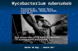 World TB Day - March 24 th Mycobacterium tuberculosis Presented By: Haneen Oueis, Suzanne Midani, Rodney Rosfeld, Lisa Petty.