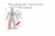 Peripheral Vascular Disease. Peripheral Artery Disease Peripheral Venous Disorders Carotid Artery Disease Peripheral Artery Disease Peripheral Renal Disease.