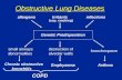 Obstructive Lung Diseases infectionsIrritantsallergens (esp. smoking) Genetic Predisposition bronchospasm AsthmaEmphysema destruction of alveolar walls.