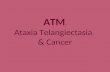 ATM, Ataxia Telangiectasia, & Cancer. Ataxia Telangiectasia Characterized by: Cerebellar deterioration Oculocutaneous telangiectasia Immunodeficiency.