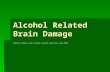 Alcohol Related Brain Damage Charlie Place York Street Health Practice Sep 2014.