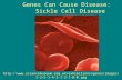 Genes Can Cause Disease: Sickle Cell Disease .