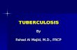 TUBERCULOSIS By Fahad Al Majid, M.D., FRCP. MICROBIOLOGY Organism: Organism: –Mycobacterium tuberculosis –Aerobic –Non-spore forming,non-motile –Rod..: