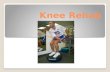 Knee Rehab. When injuries occur, the focus of the athlete shifts from injury prevention to injury treatment and rehabilitation Treatment and rehabilitation.