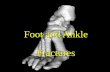 Foot and Ankle Fractures. Anatomy Three groups of stabilizing ligaments : 1)Lateral -anterior talofibular ligament (ATFL) -calcaneofibular ligament (CFL)