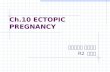 Ch.10 ECTOPIC PREGNANCY 부산백병원 산부인과 R2 서영진. Implantation anywhere (normally, endometrial lining of the uterine cavity) 2% in U.S.A >95% : involve oviduct.