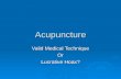 Acupuncture Valid Medical Technique Or Lucrative Hoax?