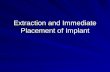 Extraction and Immediate Placement of Implant. Introduction The dental implants revolutionized the practice of dentistry and have become a successful,