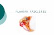 PLANTAR FASCIITIS. Patho-physiology  Repeated tensile and compressional stresses on the arched foot  Fascial anatomy focusing stress into narrow band.