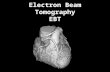Electron Beam Tomography EBT. I’ve never heard of it, (and it doesn’t sound good) Electrons –Atomic particles –Have mass Wouldn’t a beam of particulate.