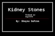 Kidney Stones By: Shayna DuPree Friend or Foe????.