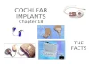 COCHLEAR IMPLANTS Chapter 18 THE FACTS. CI Manufacturers Medel Bionics Cochlear.