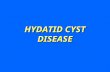 HYDATID CYST DISEASE. 1 Echinococcus granulosus cystic echinococcosis 2 Echinococcus multilocularis alveolar echinococcosis.