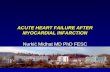 ACUTE HEART FAILURE AFTER MYOCARDIAL INFARCTION Nurkić Midhat MD PhD FESC.