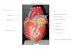 Aorta Left Pulmonary Arteries Left Atrium Coronary Sulcus Left Ventricle Anterior Interventricular Sulcus Right Ventricle Superior Vena Cava Right Atrium.