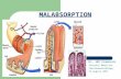 MALABSORPTION Dr. WM Simmonds Internal Medicine (Gastroenterology) 15 August 2011.