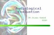 Audiological Evaluation DR.Osama Hamed KAUH. Hearing loss prevention Noise controls, hearing protectors – Primary prevention  reduction or elimination.