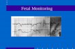 Fetal Monitoring Introduction 1600’s Kilian proposes the use of fetal heart rate to diagnose fetal distress 1893 criteria for determining fetal distress.