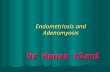 Dr Hanaa Alani Endometriosis and Adenomyosis. Endometriosis is defined as: Presence of endometrial tissues ( superficial epithelium, glands and stroma.