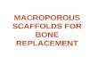 MACROPOROUS SCAFFOLDS FOR BONE REPLACEMENT. SCAFFOLD is, as in house building, a structure meant to support the growing edifice: bone regeneration Simulates.