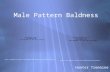 Male Pattern Baldness Hunter Tremaine  pattern+baldness.