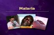 Malaria. What causes malaria? Plasmodium falciparum.