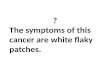 ? The symptoms of this cancer are white flaky patches.