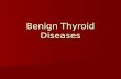 Benign Thyroid Diseases. History Goiter Goiter –Fist described in China in 2700 BC Thyroid Function Thyroid Function –Da Vinci – thyroid is designed to.