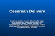 Cesarean Delivery Cesarean section means delivery of a viable fetus through an abdominal incision (i.e., laparotomy) and a uterine incision (i.e., hysterotomy).