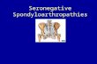 Seronegative Spondyloarthropathies. Goals of the Lecture Introduce the spondyloarthropathies Recognize AS as the prototypic disease Recognize common clinical.