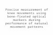 Precise measurement of knee movements using bone-fixated optical markers during performance of natural movement patterns.
