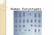 Human Karyotypes Human Karyotypes. Normal Female: 46, XX.