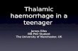 Thalamic haemorrhage in a teenager James Giles MB PhD Student The University of Manchester, UK.