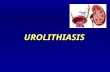 UROLITHIASIS. Theories of Stone Formation   A. Nucleation Theory   B. Stone Matrix Theory   C. Inhibitor of Crystallization Theory.