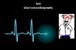 ECG Electrocardiography. -It gives useful information about the functioning of the heart. -An initial breakthrough came when Willem Einthoven, working.