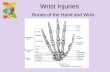 Bones of the Hand and Wrist Wrist Injuries. Olecranon Head of radius Neck of radius Styloid Process Neck of radius Head of radius Olecranon Radial notch.